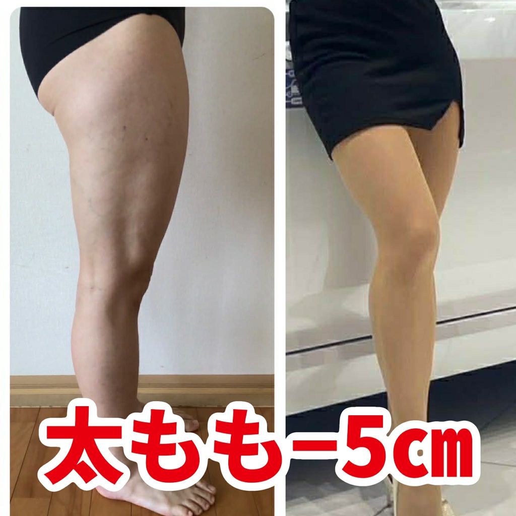 受講生の変化 太もも-5cm